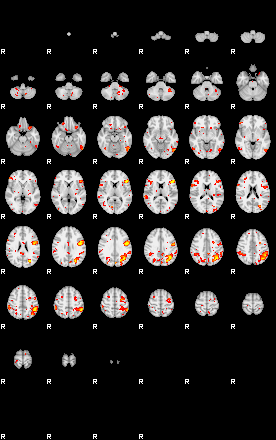 Patient:44;component:94