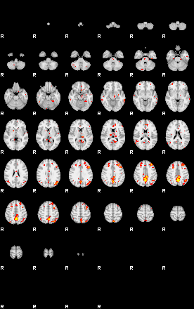 Patient:45;component:100