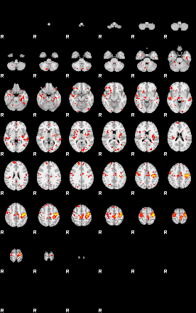 Patient:45;component:101