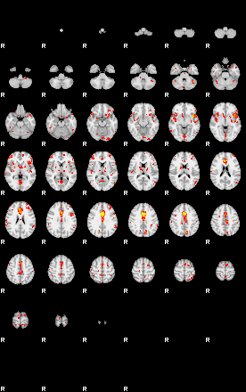 Patient:45;component:125