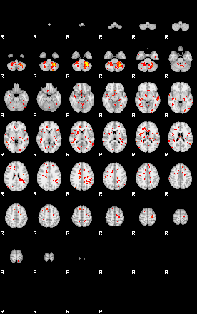 Patient:45;component:135