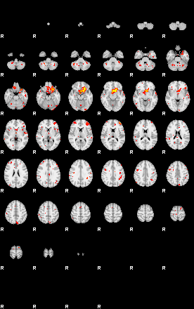 Patient:45;component:144