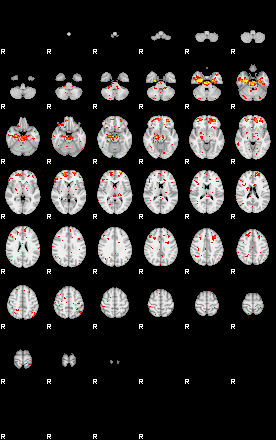 Patient:45;component:160