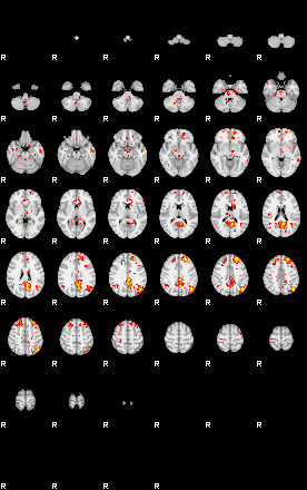 Patient:45;component:180