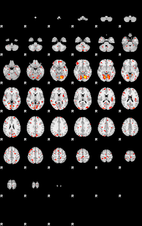 Patient:45;component:191