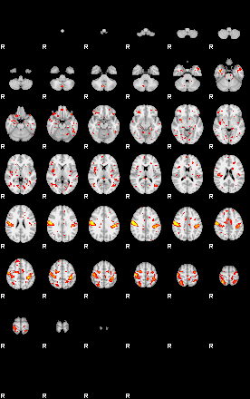 Patient:45;component:21