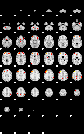 Patient:45;component:25