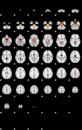 Patient:45;component:32