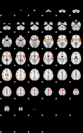 Patient:45;component:41