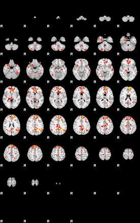 Patient:45;component:44