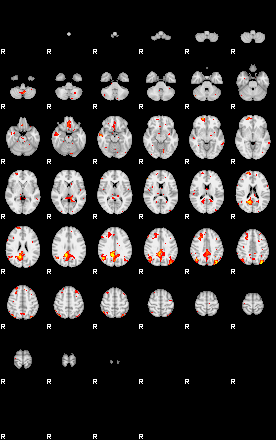 Patient:45;component:48