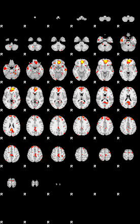 Patient:45;component:49