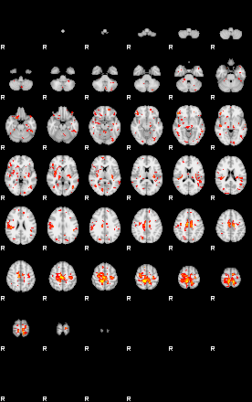 Patient:45;component:55