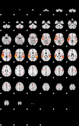 Patient:45;component:56