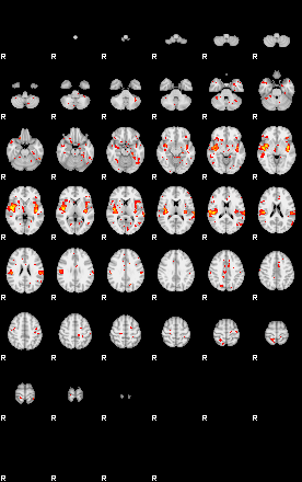 Patient:45;component:58