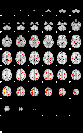 Patient:45;component:75