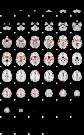 Patient:45;component:90