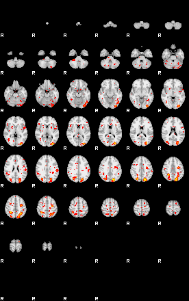 Patient:46;component:111