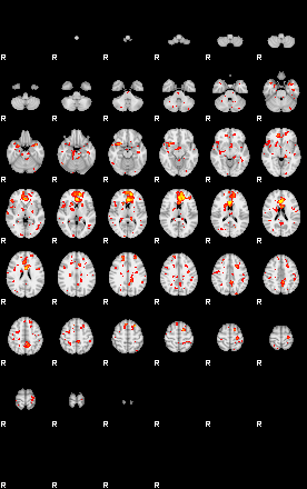 Patient:46;component:125