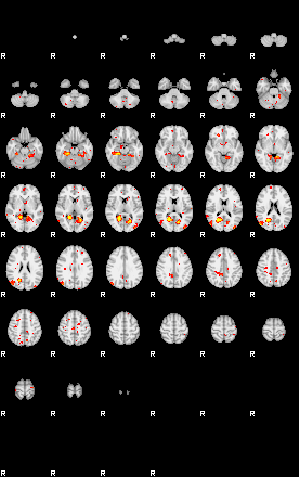 Patient:46;component:161