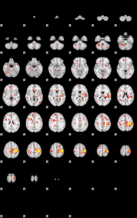 Patient:46;component:21