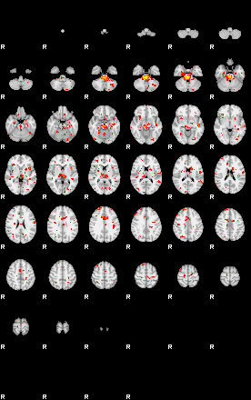 Patient:46;component:32