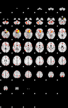 Patient:46;component:43