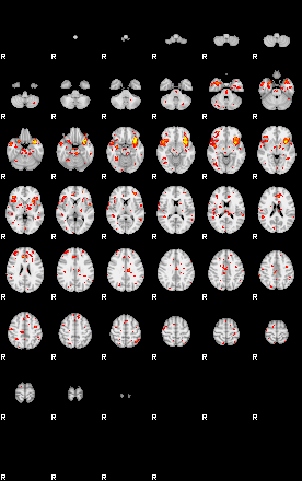 Patient:46;component:52