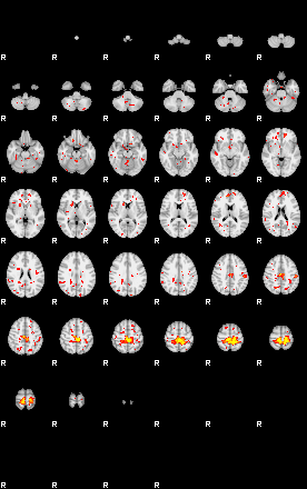 Patient:46;component:55