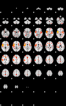 Patient:46;component:58