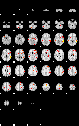 Patient:47;component:10