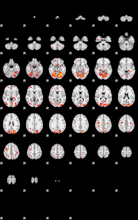 Patient:47;component:126