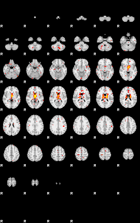 Patient:47;component:174