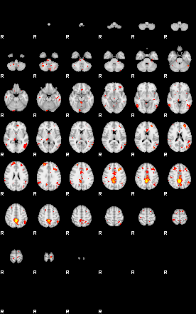 Patient:47;component:180