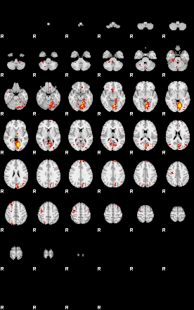 Patient:47;component:191