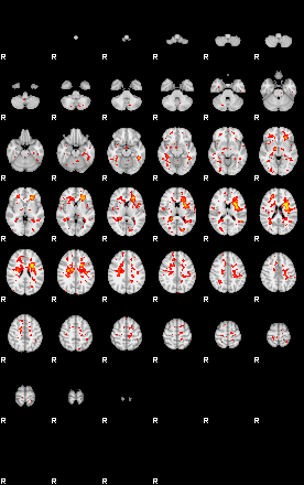 Patient:47;component:35