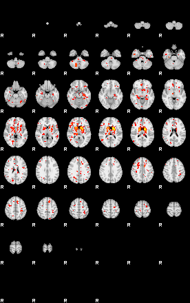 Patient:47;component:39