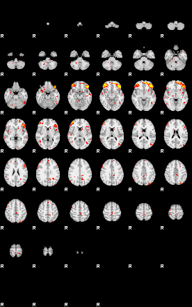 Patient:47;component:42