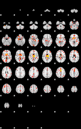 Patient:47;component:47