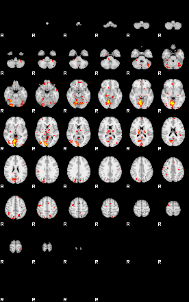 Patient:47;component:51