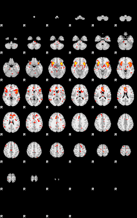 Patient:47;component:52