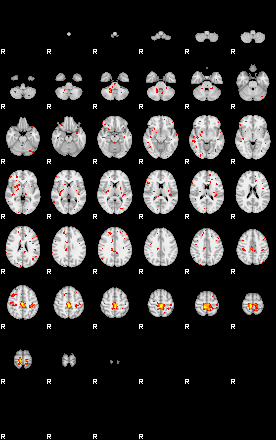 Patient:47;component:55