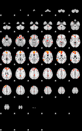 Patient:47;component:72