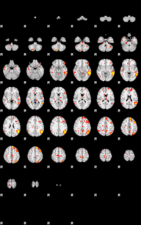 Patient:48;component:10