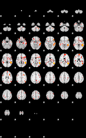 Patient:48;component:107