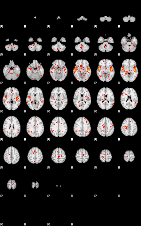 Patient:48;component:11