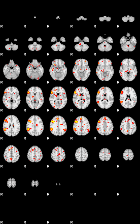 Patient:48;component:119