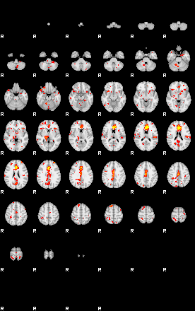 Patient:48;component:125