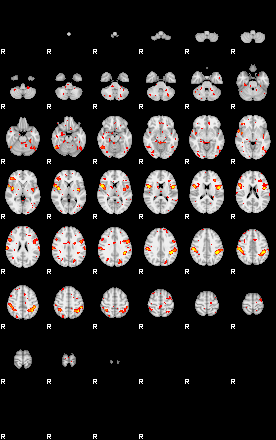 Patient:48;component:141