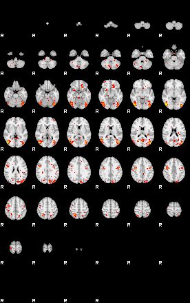 Patient:48;component:143